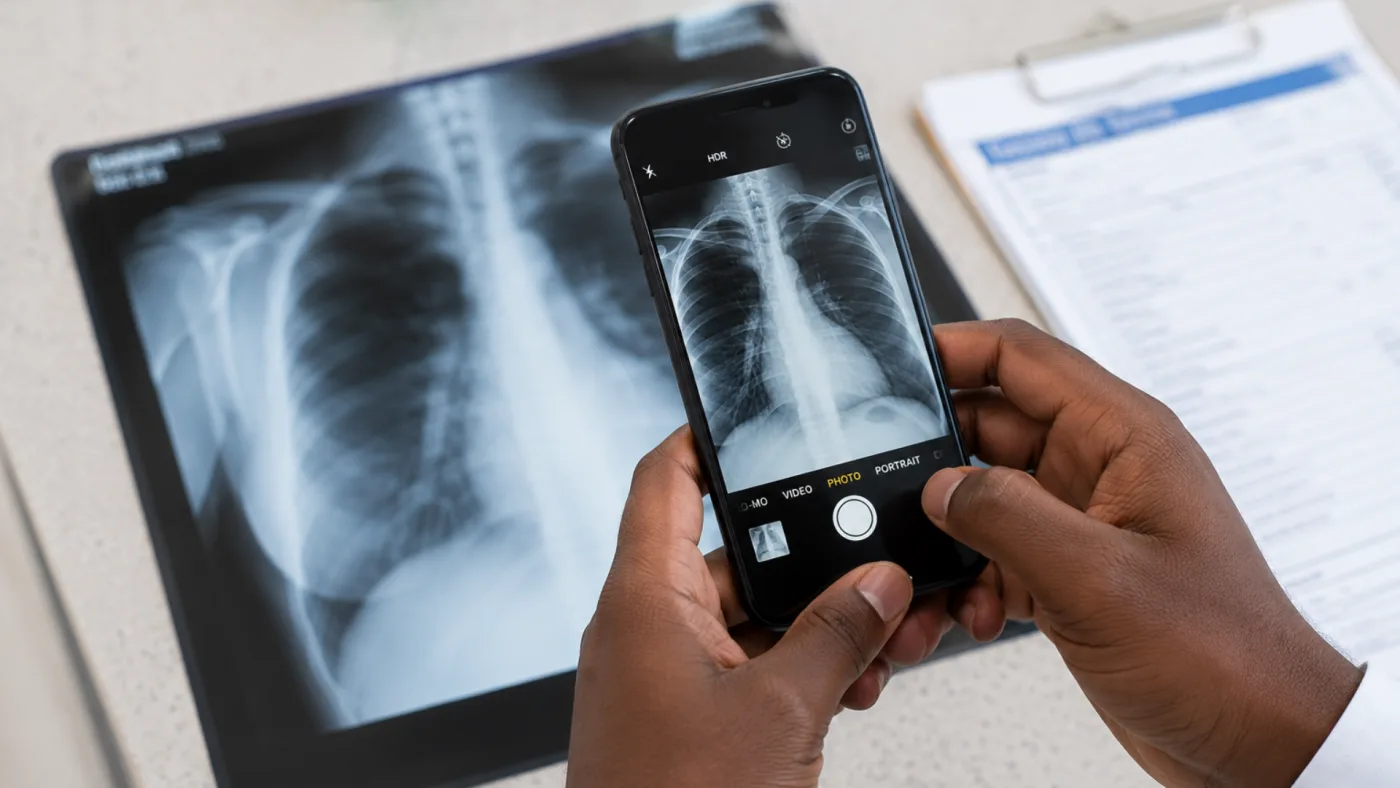 A patient photographing a chest X-ray with a phone